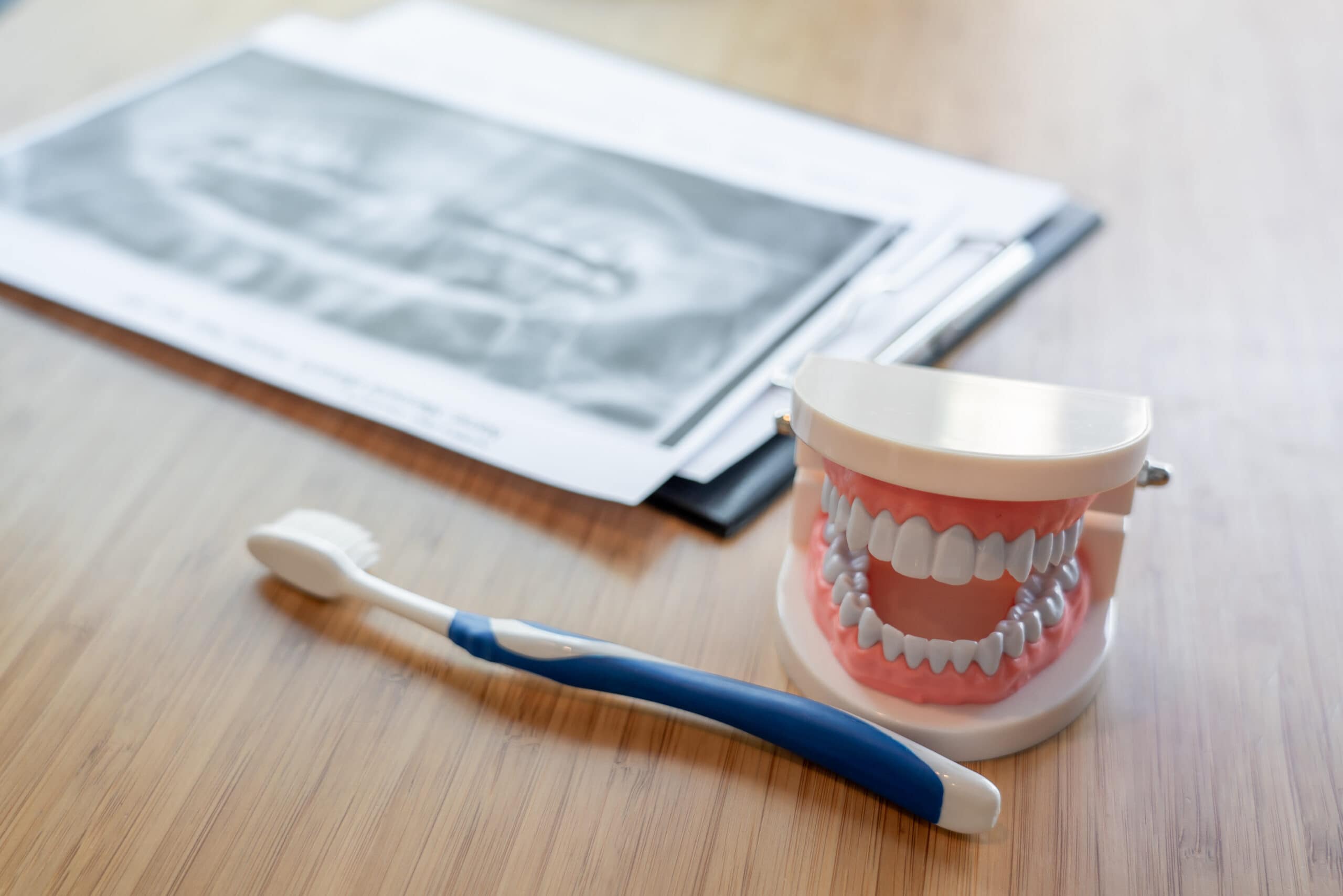 Dental model with toothbrush and X-ray at Broken Arrow dentist office