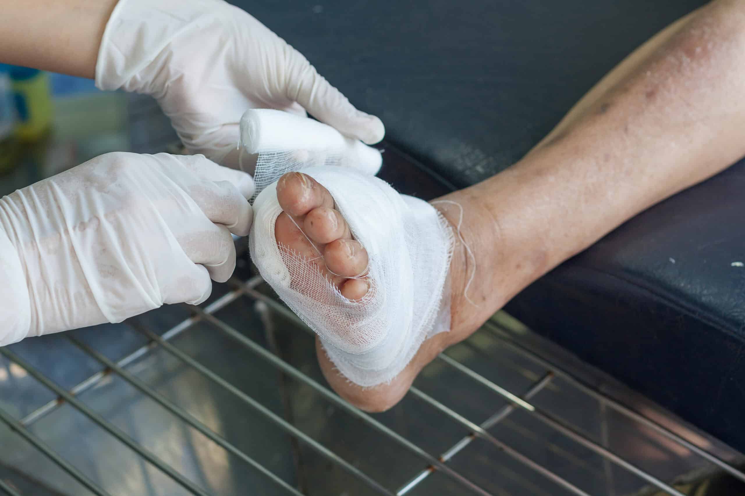 diabetic footcare in Tulsa, OK